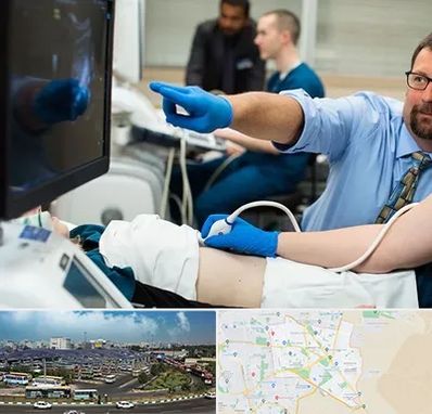 سونوگرافی شبانه روزی در منطقه 15 تهران 