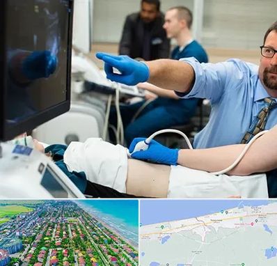 سونوگرافی شبانه روزی در فریدونکنار