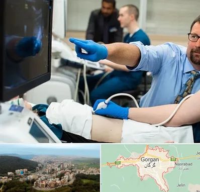 سونوگرافی شبانه روزی در گرگان