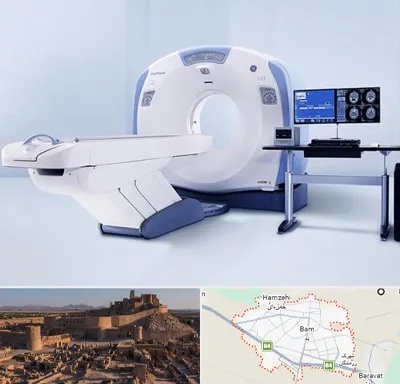سی تی اسکن شبانه روزی در بم