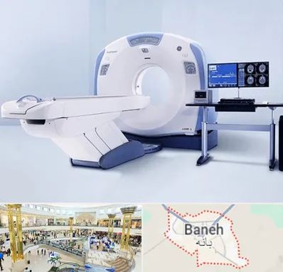 سی تی اسکن شبانه روزی در بانه