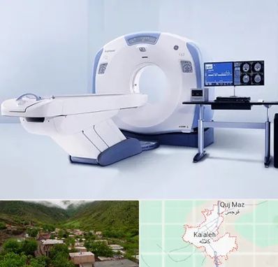 سی تی اسکن شبانه روزی در کلاله