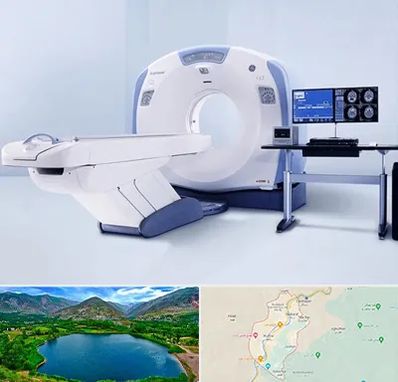 سی تی اسکن شبانه روزی در رودبار