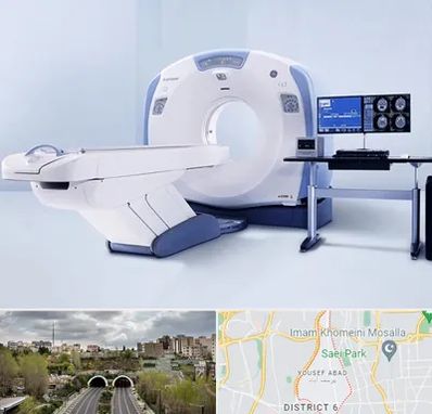 سی تی اسکن شبانه روزی در یوسف آباد 