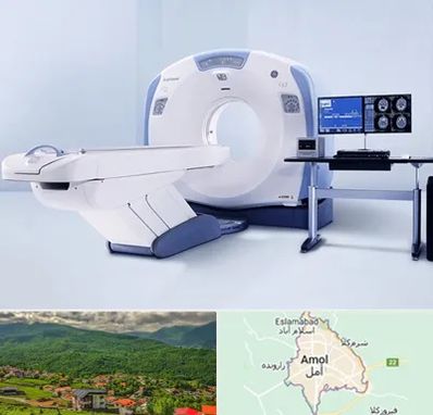 سی تی اسکن شبانه روزی در آمل
