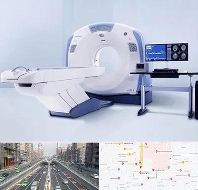 سی تی اسکن شبانه روزی در توحید 