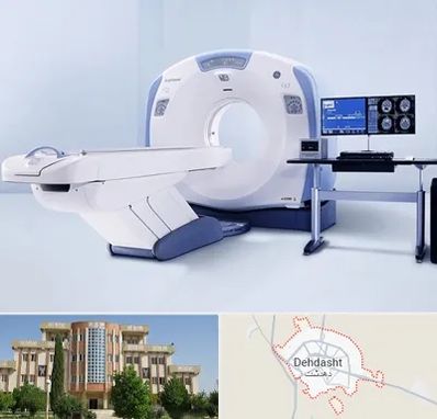 سی تی اسکن شبانه روزی در دهدشت