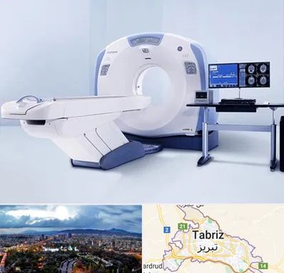 سی تی اسکن شبانه روزی در تبریز