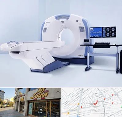 سی تی اسکن شبانه روزی در عطاران قم