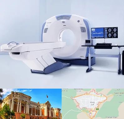 سی تی اسکن شبانه روزی در خوی