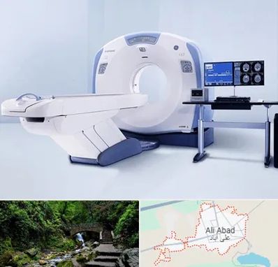 سی تی اسکن شبانه روزی در علی آباد کتول
