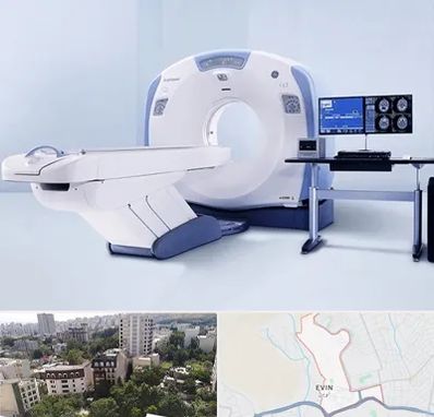 سی تی اسکن شبانه روزی در اوین
