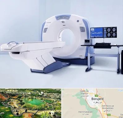 سی تی اسکن شبانه روزی در بروجرد
