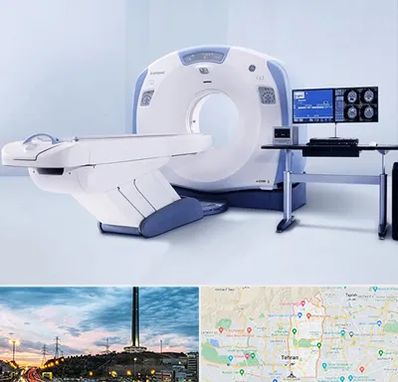 سی تی اسکن شبانه روزی در منطقه 2 تهران 