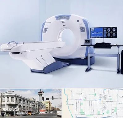 سی تی اسکن شبانه روزی در 17شهریور
