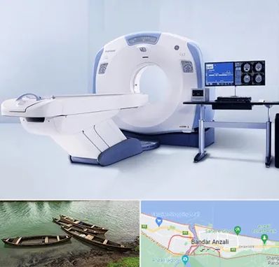 سی تی اسکن شبانه روزی در بندر انزلی