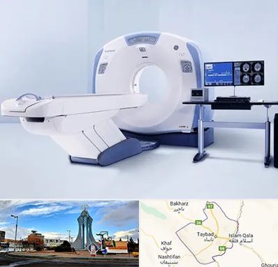 سی تی اسکن شبانه روزی در تایباد