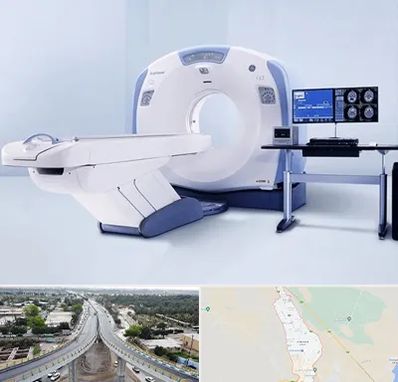 سی تی اسکن شبانه روزی در اندیمشک