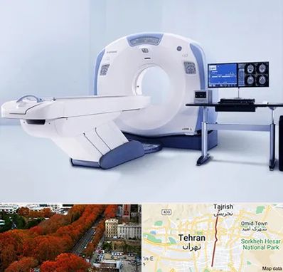 سی تی اسکن شبانه روزی در ولیعصر 