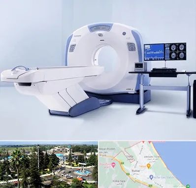 سی تی اسکن شبانه روزی در رودسر