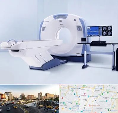 سی تی اسکن شبانه روزی در منطقه 7 تهران 