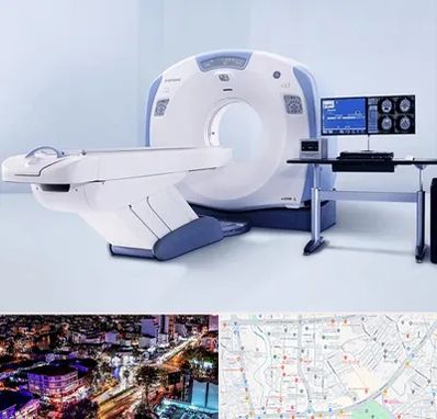 سی تی اسکن شبانه روزی در منظریه رشت