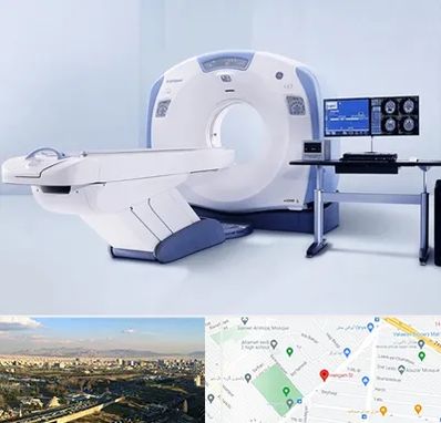 سی تی اسکن شبانه روزی در هنگام 