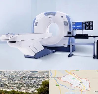سی تی اسکن شبانه روزی در یاسوج