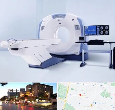 سی تی اسکن شبانه روزی در بلوار سجاد مشهد 