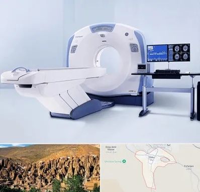 سی تی اسکن شبانه روزی در اسکو