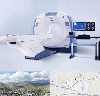 سی تی اسکن شبانه روزی در رودهن