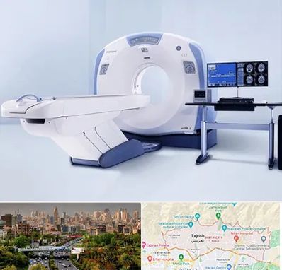 سی تی اسکن شبانه روزی در منطقه 1 تهران 