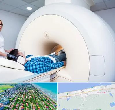 ام ار ای شبانه روزی در فریدونکنار