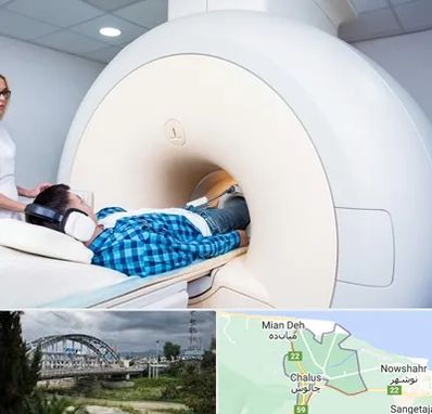 ام ار ای شبانه روزی در چالوس