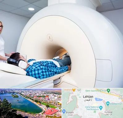 ام ار ای شبانه روزی در لاهیجان