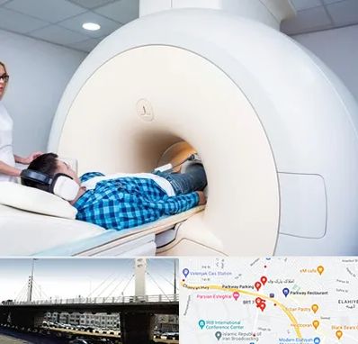 ام ار ای شبانه روزی در پارک وی 