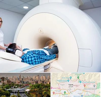 ام ار ای شبانه روزی در منطقه 1 تهران 