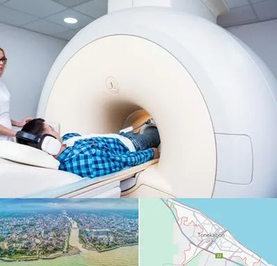 ام ار ای شبانه روزی در تنکابن