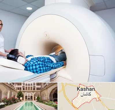 ام ار ای شبانه روزی در کاشان