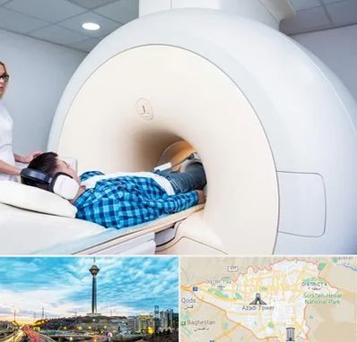 ام ار ای شبانه روزی در تهران