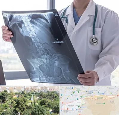 رادیولوژی شبانه روزی در منطقه 13 تهران 