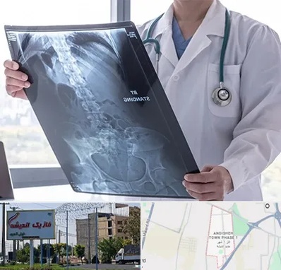 رادیولوژی شبانه روزی در فاز یک اندیشه