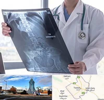 رادیولوژی شبانه روزی در تایباد