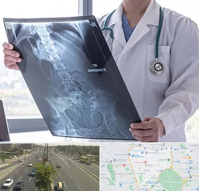 رادیولوژی شبانه روزی در منطقه 17 تهران 