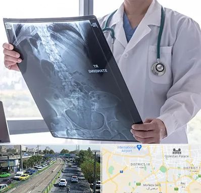 رادیولوژی شبانه روزی در جنوب تهران 