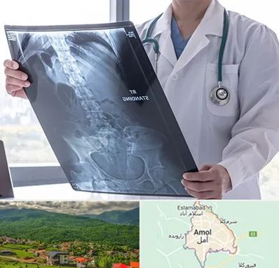 رادیولوژی شبانه روزی در آمل