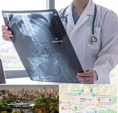 رادیولوژی شبانه روزی در منطقه 1 تهران 