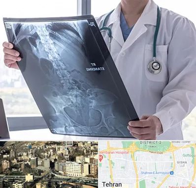 رادیولوژی شبانه روزی در مرزداران 