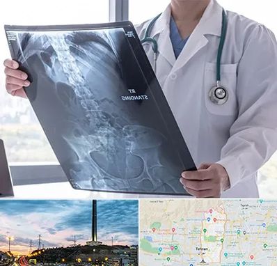 رادیولوژی شبانه روزی در منطقه 2 تهران 