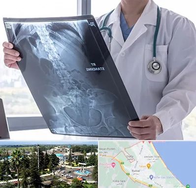 رادیولوژی شبانه روزی در رودسر